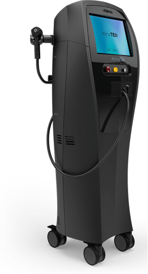 Alma TED - Hair Loss Solution Mississauga Oakville